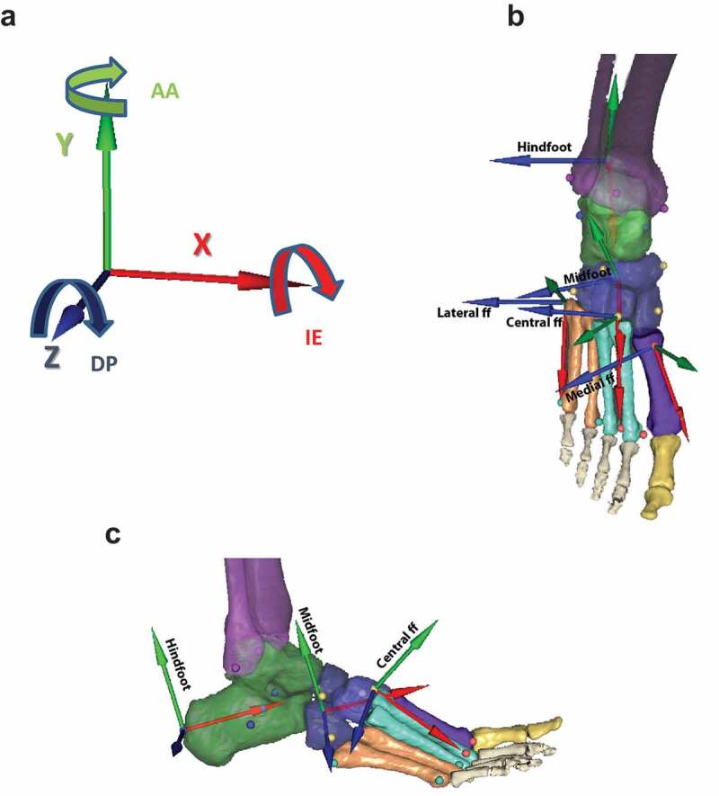 Metatarsal arch deformation and forefoot kinematics during gait in asymptomatic subjects.
