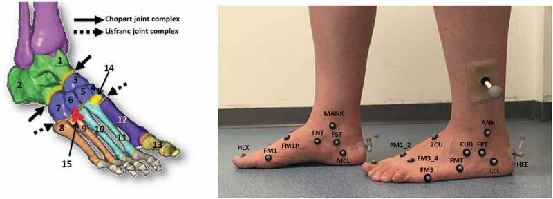Metatarsal arch deformation and forefoot kinematics during gait in asymptomatic subjects.