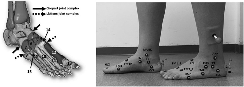 Metatarsal arch deformation and forefoot kinematics during gait in asymptomatic subjects.