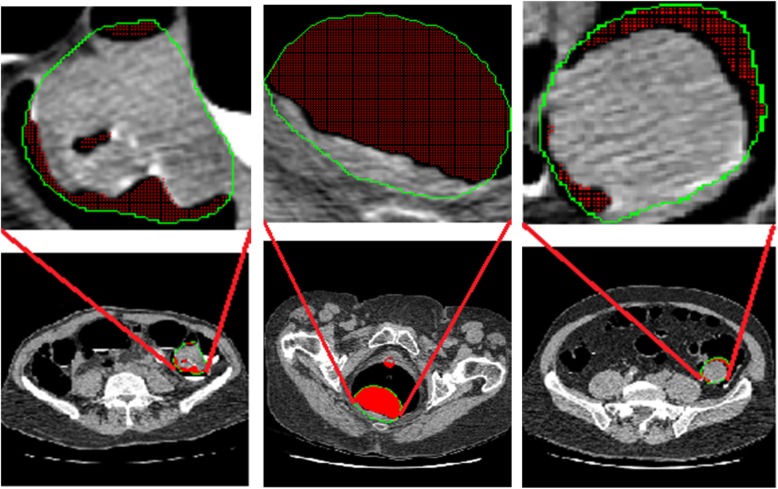 Multi-scale characterizations of colon polyps via computed tomographic colonography.