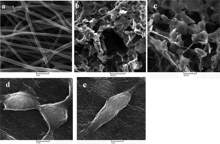 A novel polycaprolactone/carbon nanofiber composite as a conductive neural guidance channel: an in vitro and in vivo study.