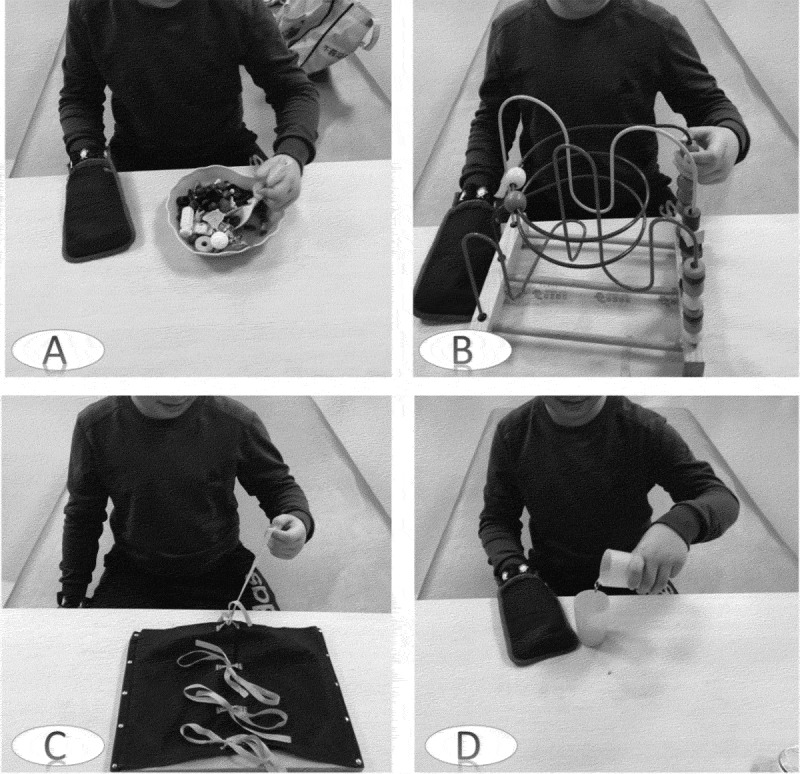 Comparison of the effects of modified constraint-induced movement therapy and intensive conventional therapy with a botulinum-a toxin injection on upper limb motor function recovery in patients with stroke.