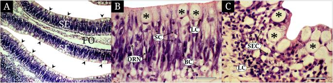 Anatomy, ultrastructure and histology of the olfactory organ of the largemouth bass Micropterus salmoides, Centrarchidae