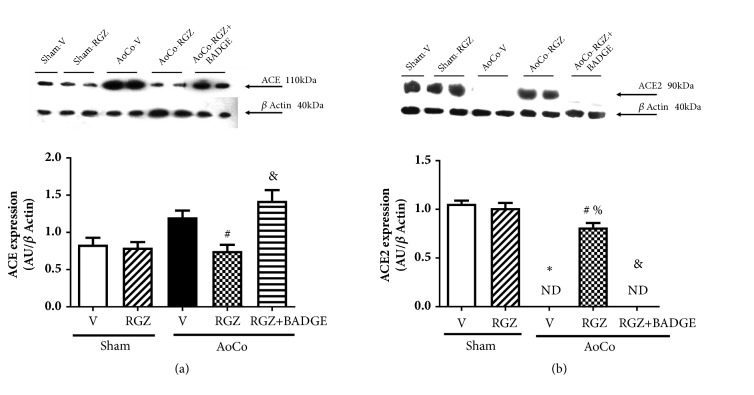 Rosiglitazone, a Ligand to PPAR<i>γ</i>, Improves Blood Pressure and Vascular Function through Renin-Angiotensin System Regulation.