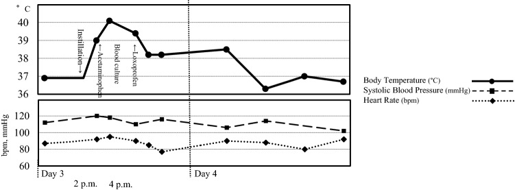 Acute Exacerbation of Fever Following Administration of Tropicamide and Phenylephrine Ophthalmic Solution: A Case Report.