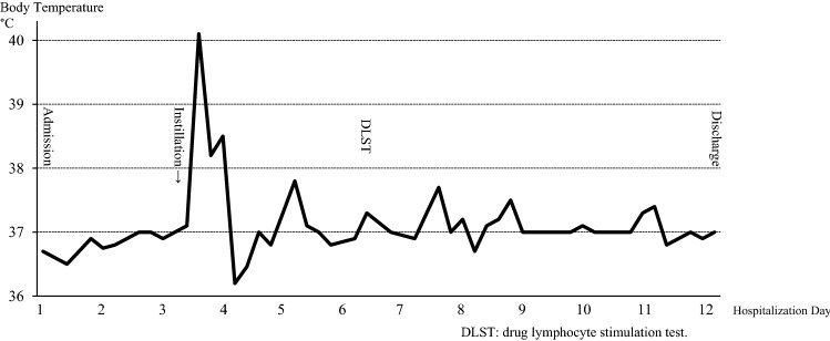 Acute Exacerbation of Fever Following Administration of Tropicamide and Phenylephrine Ophthalmic Solution: A Case Report.