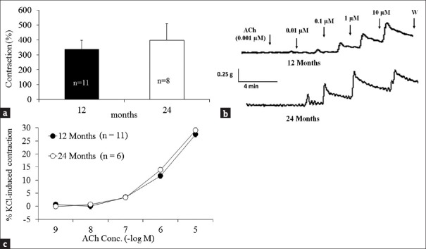 The aging effects on phenylephrine-induced relaxation of bladder in mice.