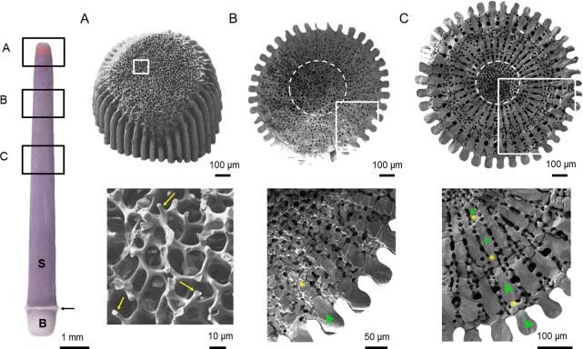 Growth and regrowth of adult sea urchin spines involve hydrated and anhydrous amorphous calcium carbonate precursors