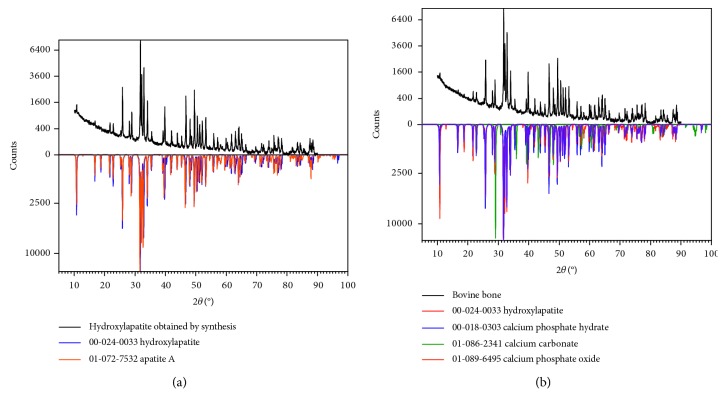 Analysis of <i>In Vitro</i> Osteoblast Culture on Scaffolds for Future Bone Regeneration Purposes in Dentistry.