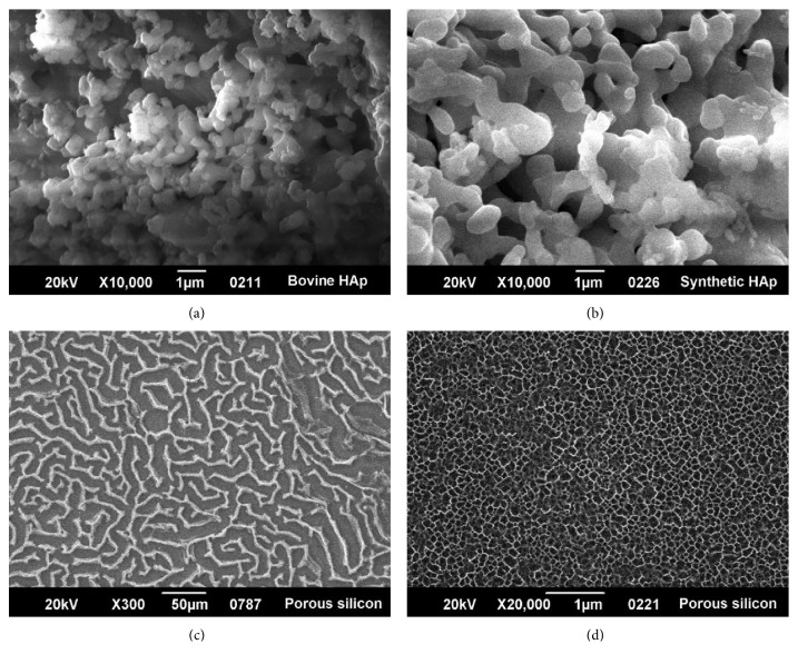 Analysis of <i>In Vitro</i> Osteoblast Culture on Scaffolds for Future Bone Regeneration Purposes in Dentistry.