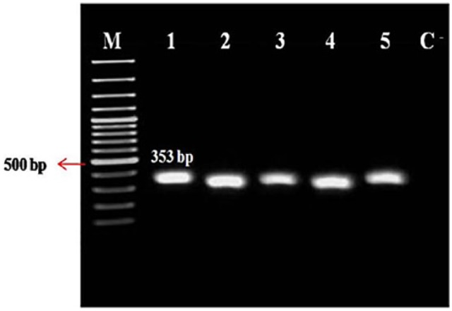 Molecular identification and genotyping of <i>Acinetobacter baumannii</i> isolated from burn patients by PCR and ERIC-PCR.