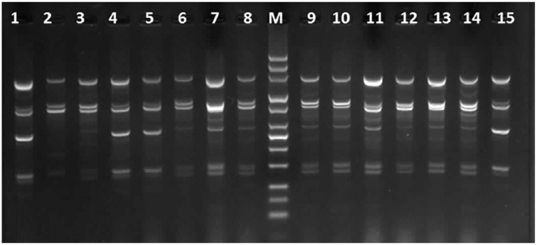 Molecular identification and genotyping of <i>Acinetobacter baumannii</i> isolated from burn patients by PCR and ERIC-PCR.