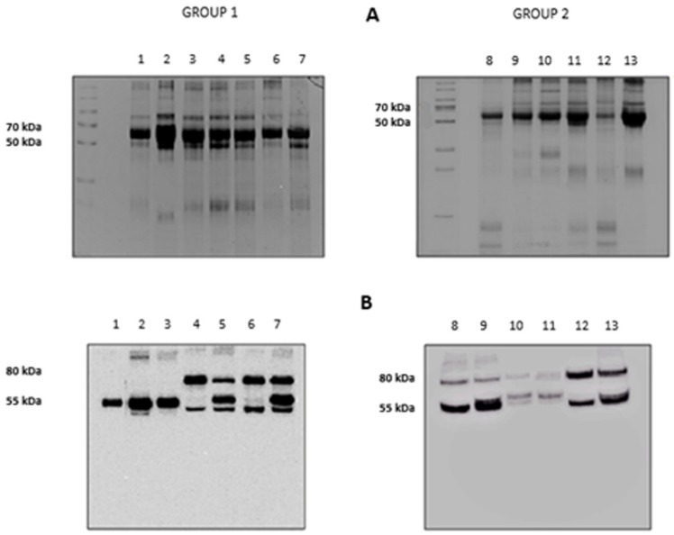 A Pilot Study to Investigate the Balance between Proteases and α1-Antitrypsin in Bronchoalveolar Lavage Fluid of Lung Transplant Recipients.