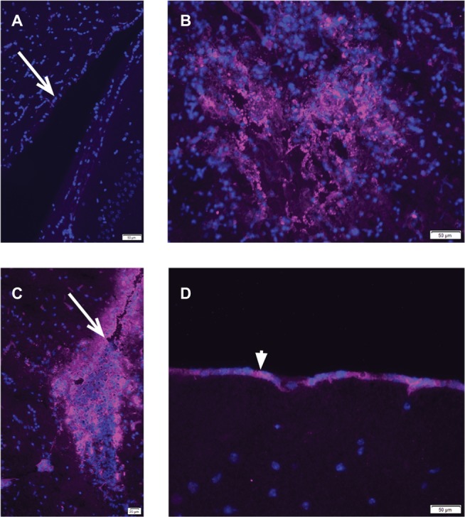 A cautionary note on the selectivity of oncolytic poxviruses.