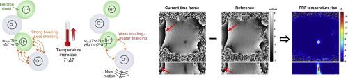 Magnetic resonance thermometry and its biological applications – Physical principles and practical considerations