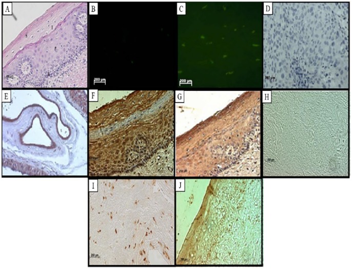 RBBP6 Is Abundantly Expressed in Human Cervical Carcinoma and May Be Implicated in Its Malignant Progression.