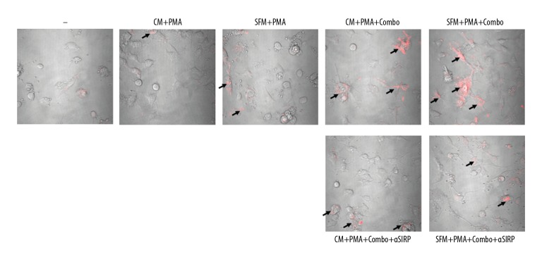 Effect of Serum Deprivation Stress on Signal Induction Regulatory Protein-Alpha (SIRP-Alpha)-Mediated Erythrophagocytosis by Macrophages.