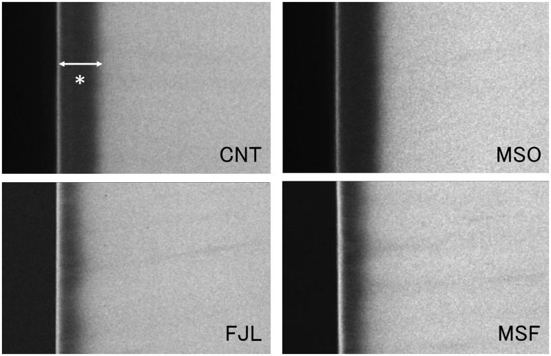 Anti-demineralization effect of desensitizer containing copolymer and sodium fluoride on root dentin - a transverse microradiographic study.