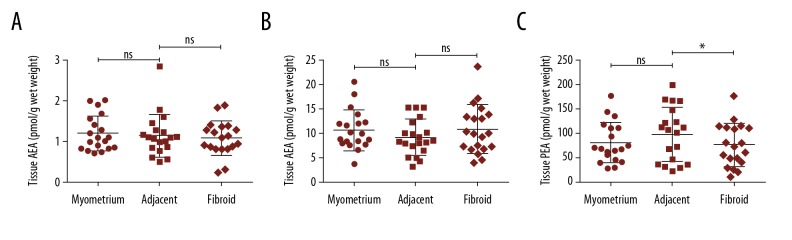 New Insights of Uterine Leiomyoma Pathogenesis: Endocannabinoid System.