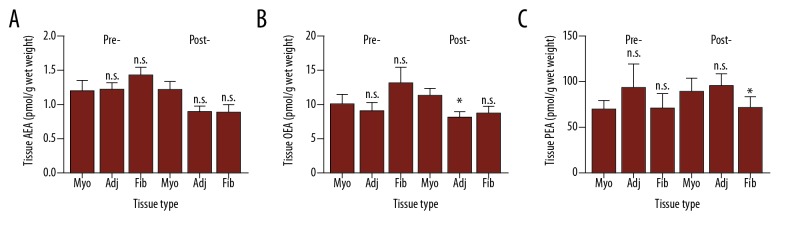 New Insights of Uterine Leiomyoma Pathogenesis: Endocannabinoid System.