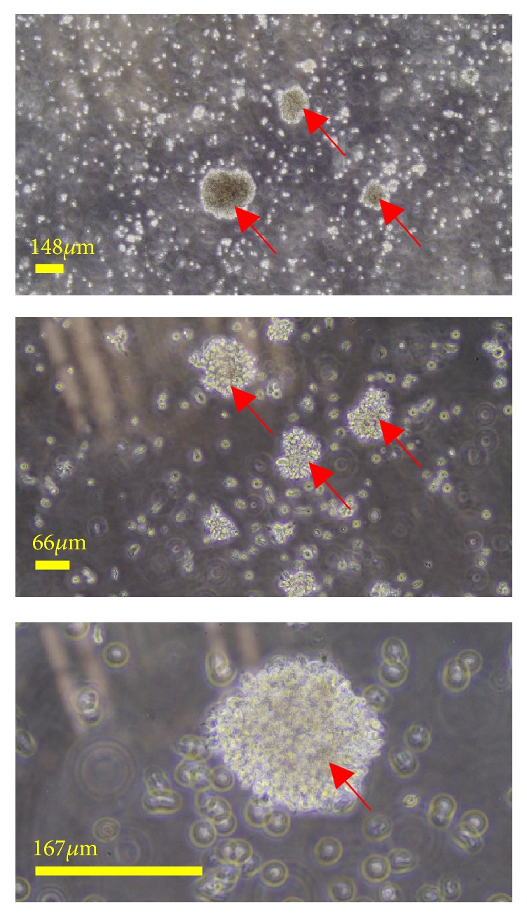 Epstein-Barr Virus- (EBV-) Immortalized Lymphoblastoid Cell Lines (LCLs) Express High Level of CD23 but Low CD27 to Support Their Growth.