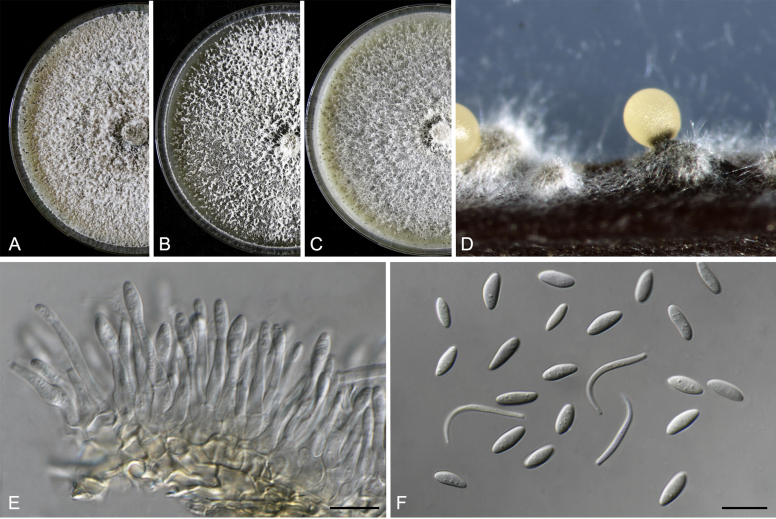 Genera of phytopathogenic fungi: GOPHY 2