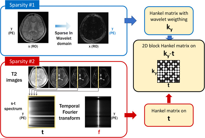 Compressed sensing MRI: a review from signal processing perspective.