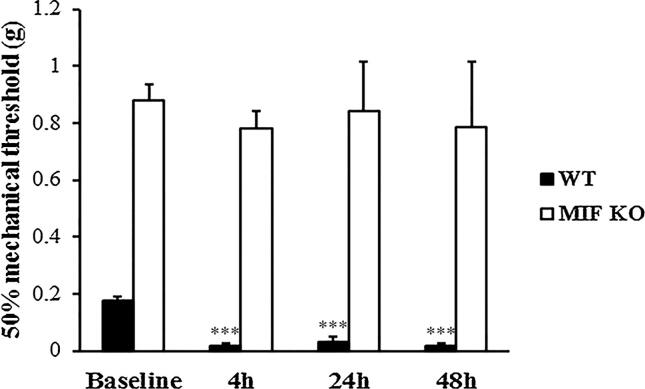 MIF mediates bladder pain, not inflammation, in cyclophosphamide cystitis