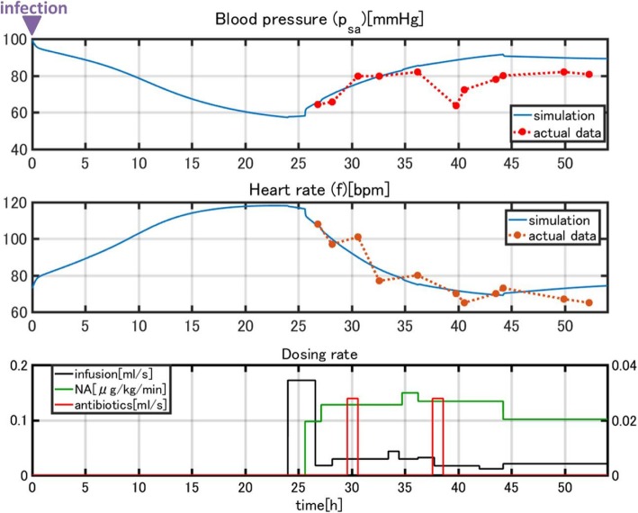 Mathematical modeling of septic shock based on clinical data.