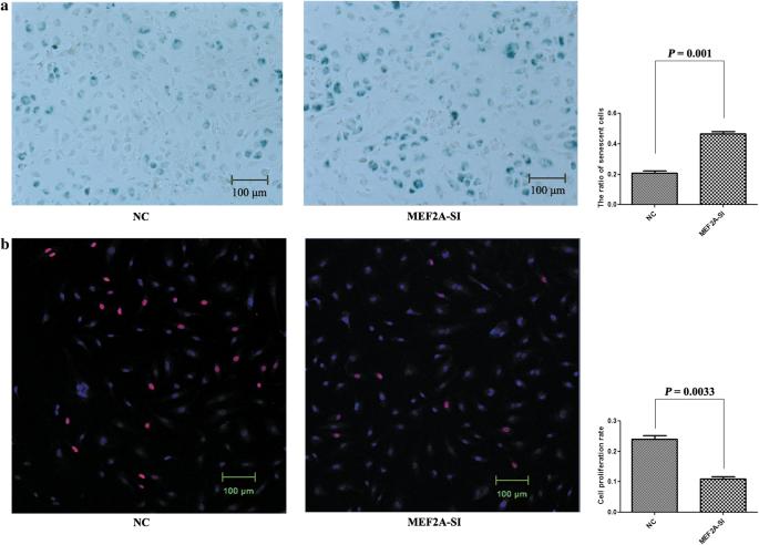 MEF2A alters the proliferation, inflammation-related gene expression profiles and its silencing induces cellular senescence in human coronary endothelial cells