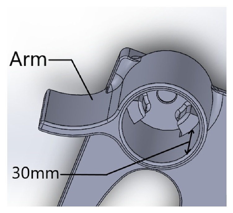 Use of a Tablet Attachment in Teleophthalmology for Real-Time Video Transmission from Rural Vision Centers in a Three-Tier Eye Care Network in India: eyeSmart Cyclops.