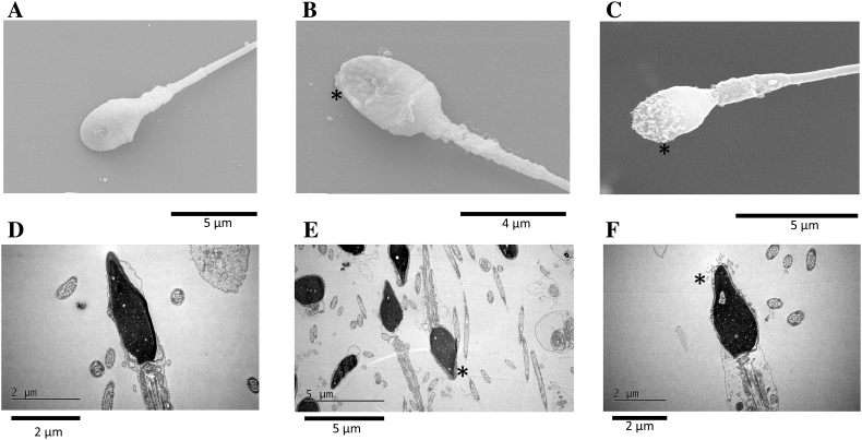 Tideglusib, a prospective alternative to nonoxynol-9 contraceptive