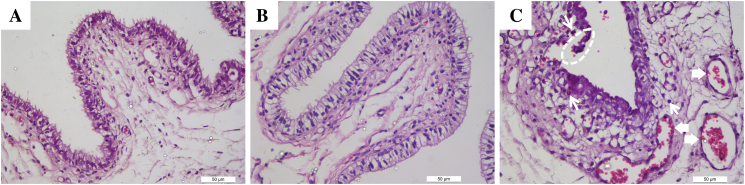 Tideglusib, a prospective alternative to nonoxynol-9 contraceptive