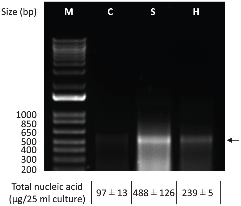 Microbial-Based Double-Stranded RNA Production to Develop Cost-Effective RNA Interference Application for Insect Pest Management.