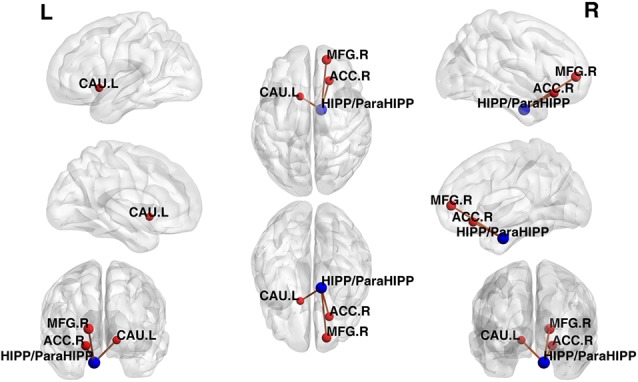 Aberrant Brain Function in Active-Stage Ulcerative Colitis Patients: A Resting-State Functional MRI Study.