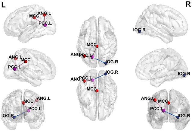 Aberrant Brain Function in Active-Stage Ulcerative Colitis Patients: A Resting-State Functional MRI Study.