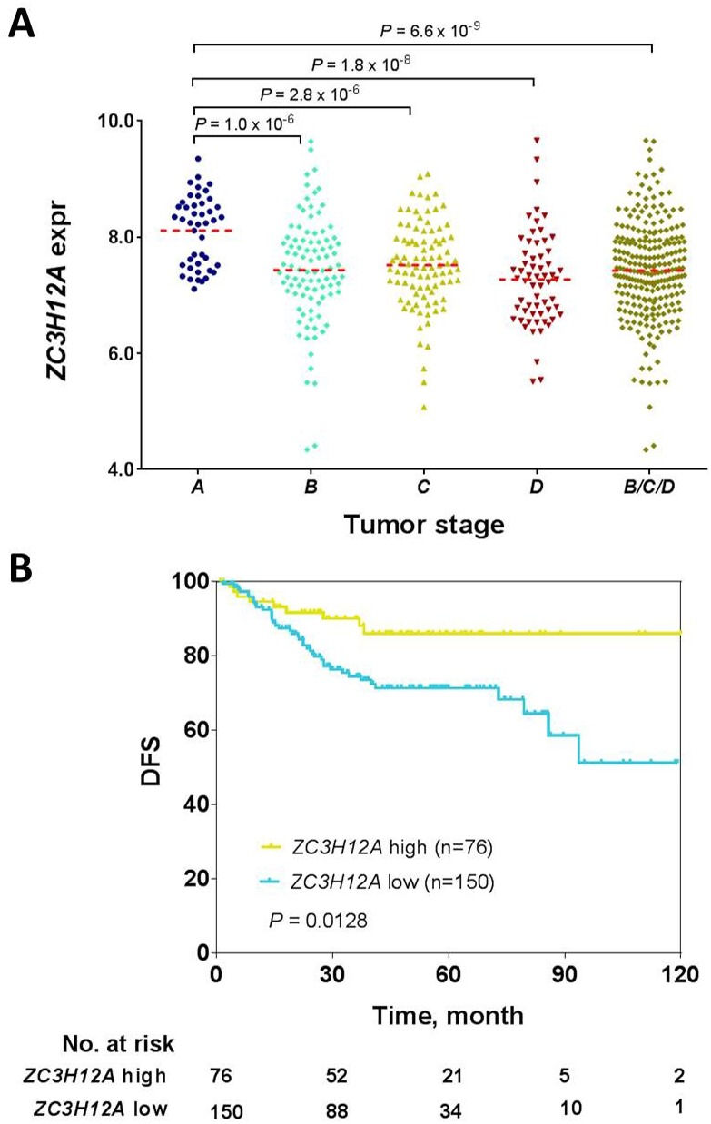 ZC3H12A Expression in Different Stages of Colorectal Cancer.