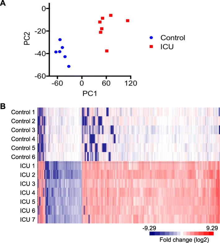 RNA-sequencing reveals altered skeletal muscle contraction, E3 ligases, autophagy, apoptosis, and chaperone expression in patients with critical illness myopathy.