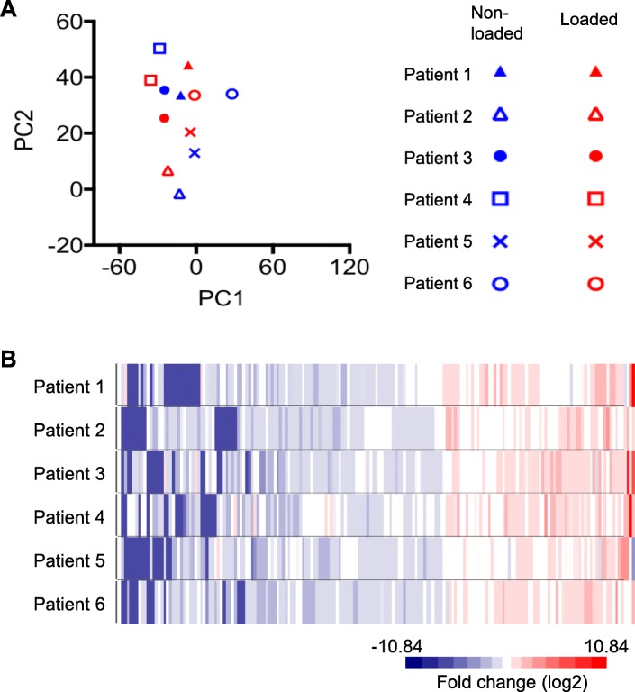 RNA-sequencing reveals altered skeletal muscle contraction, E3 ligases, autophagy, apoptosis, and chaperone expression in patients with critical illness myopathy.