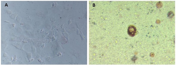 Part 1: A Novel Model for Three-Dimensional Culture of 3T3-L1 Preadipocytes Stimulates Spontaneous Cell Differentiation Independent of Chemical Induction Typically Required in Monolayer.