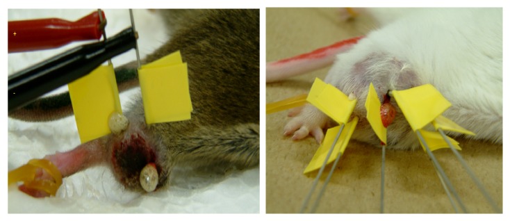 Cellular and Molecular Level Mechanisms against Electrochemical Cancer Therapy.