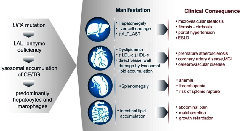 Lysosomal acid lipase deficiency - early diagnosis is the key.