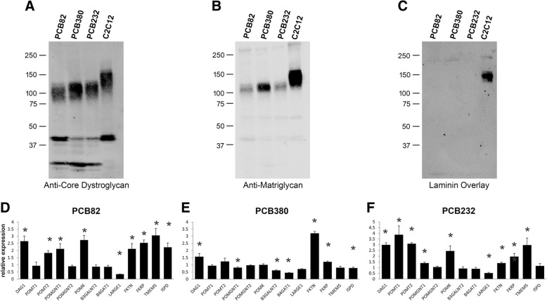 Exogenous expression of the glycosyltransferase LARGE1 restores α-dystroglycan matriglycan and laminin binding in rhabdomyosarcoma.