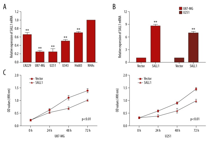 Spalt-Like Transcription Factor 1 (SALL1) Gene Expression Inhibits Cell Proliferation and Cell Migration of Human Glioma Cells Through the Wnt/β-Catenin Signaling Pathway.