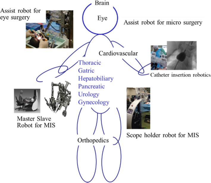 Robots in laparoscopic surgery: current and future status.