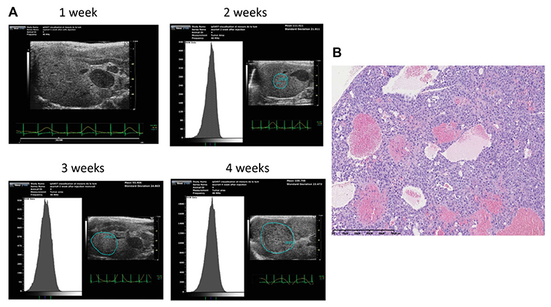 Ultrasound-Guided Approaches to Improve Orthotopic Mouse Xenograft Models for Hepatocellular Carcinoma