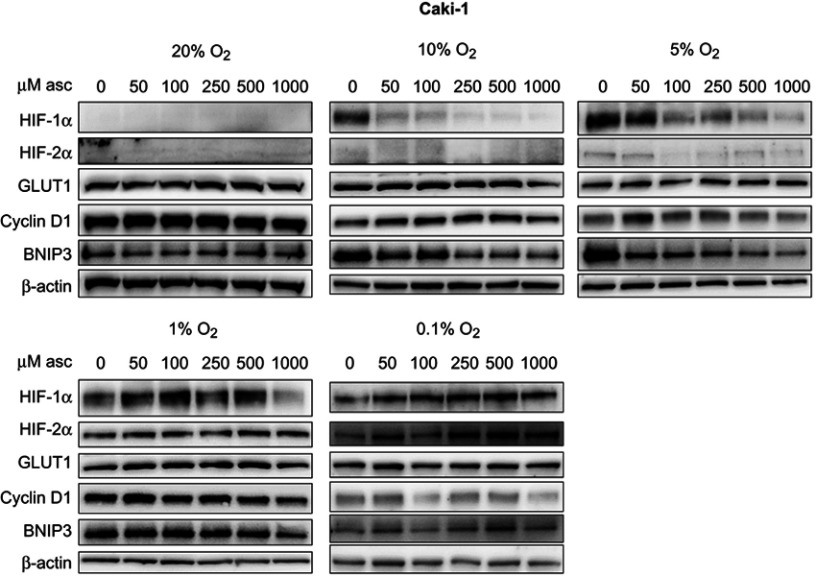 Ascorbate modulates the hypoxic pathway by increasing intracellular activity of the HIF hydroxylases in renal cell carcinoma cells.