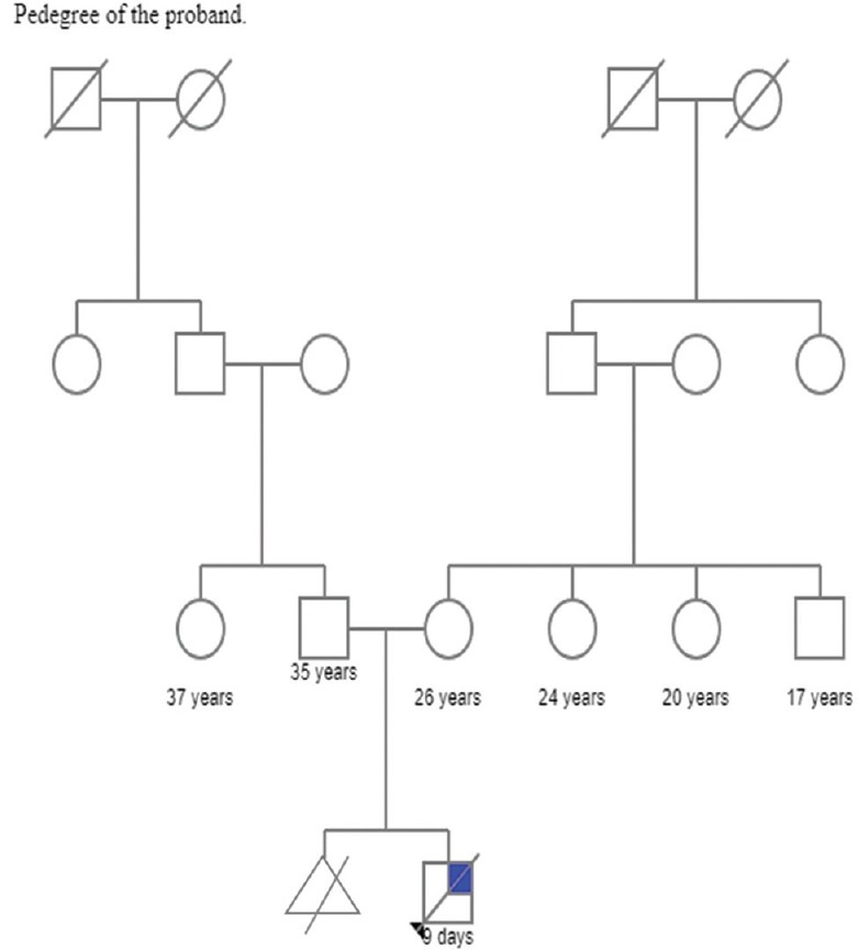 A Child with Partial Trisomy 4 (q26 - qterminal) Resulting from Paternally Inherited Translocation (4:18) Associated with Multiple Congenital Anomalies and Death.