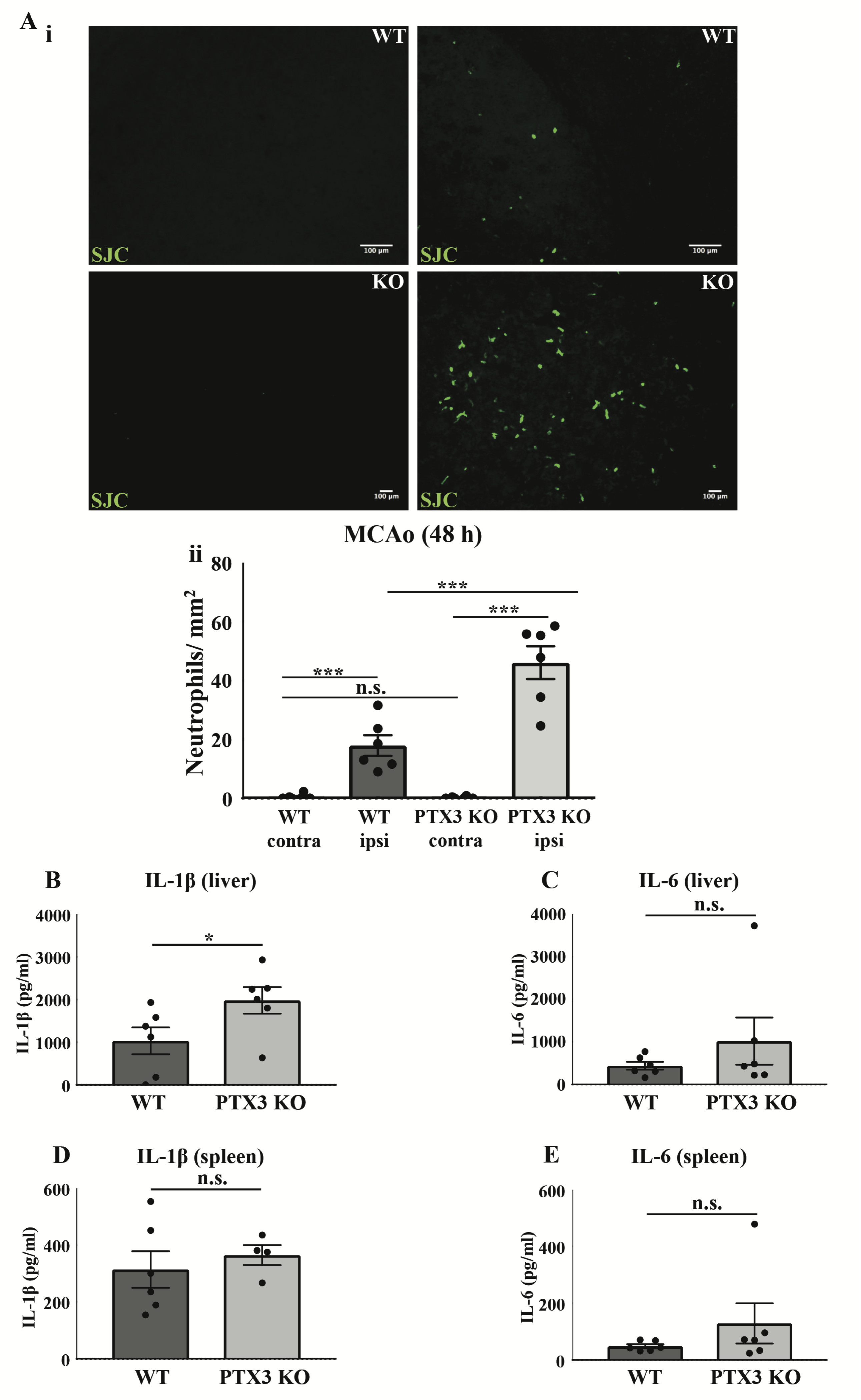 Pentraxin 3 regulates neutrophil infiltration to the brain during neuroinflammation.