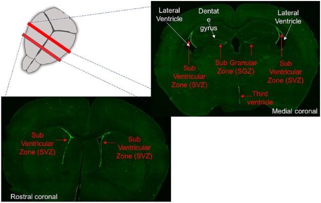 Adult Neurogenesis and the Promise of Adult Neural Stem Cells.